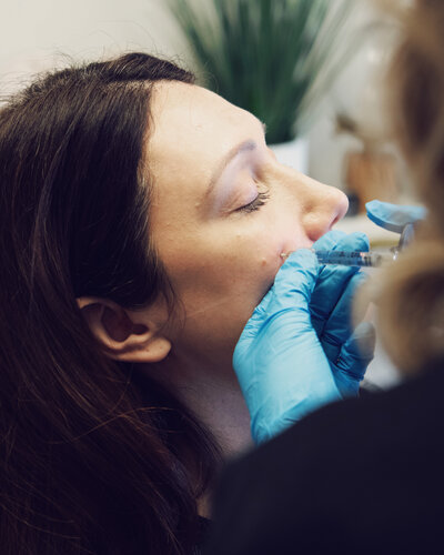 Dermal Filler