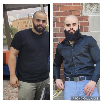 Before and after of Ali