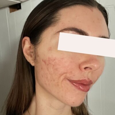 POST 2 (28)