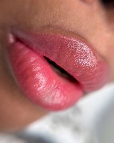 Lip Neutralization nyc