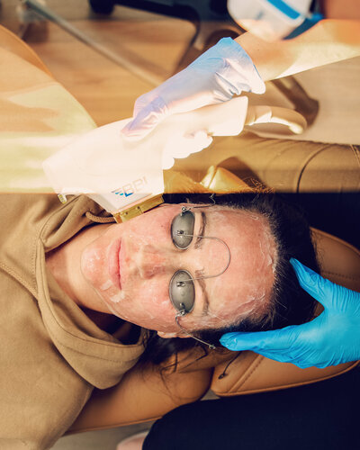 LASER TREATMENTS IN VANCOUVER WA