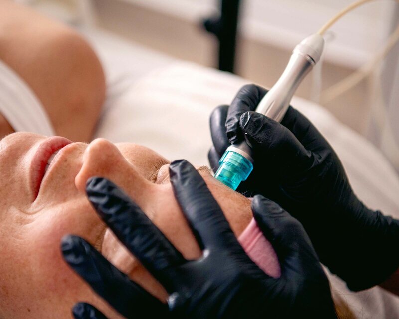 Botox in Vancouver