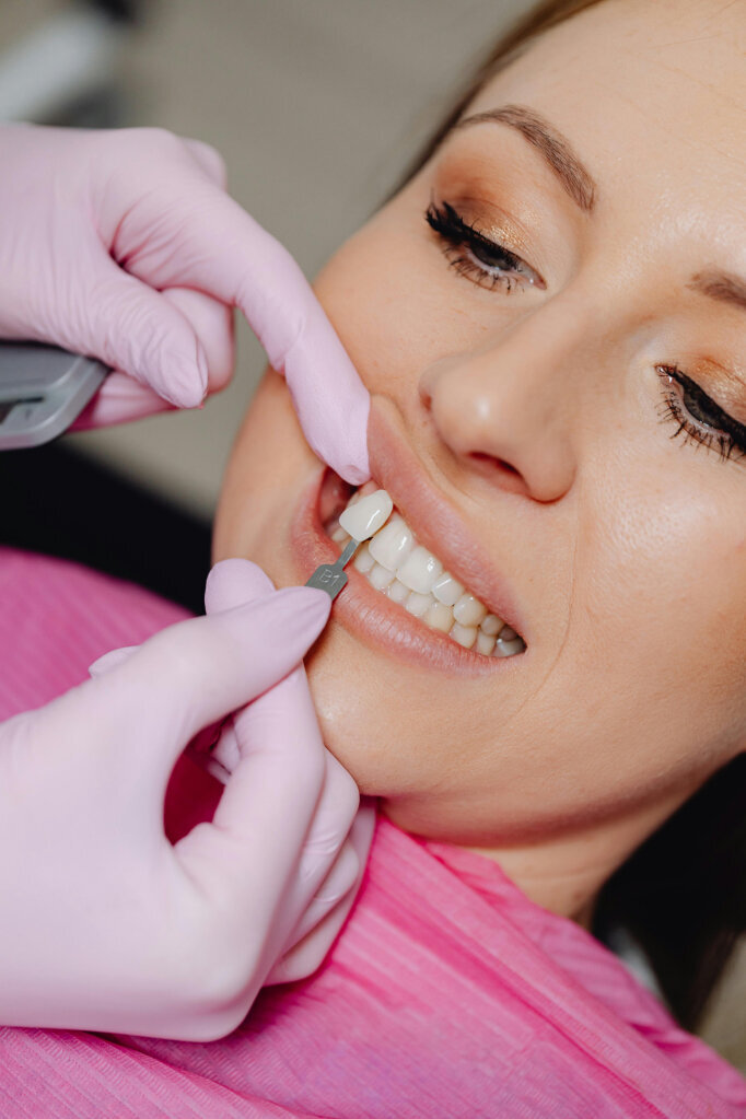 A women getting some cosmetic dentistry done. She is getting veneers to achieve a perfect smile and whiter teeth.