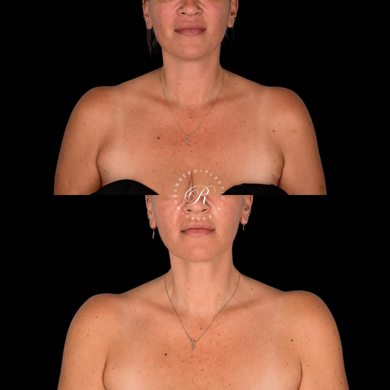 Copy of Template for Rosenberg Plastic Surgery B - 15