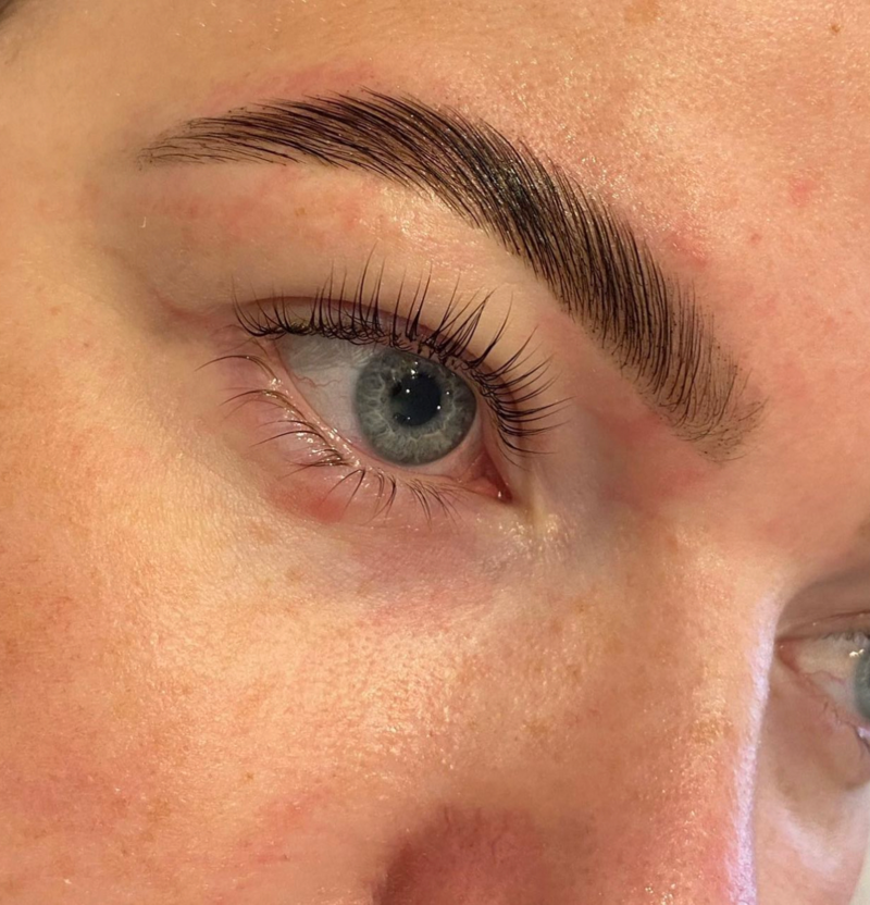 Tame unruly eyebrows with Patchogue brow lamination at Lively Esthetics & Wellness. Our expert techniques will help you achieve perfectly groomed brows that stay in place all day.