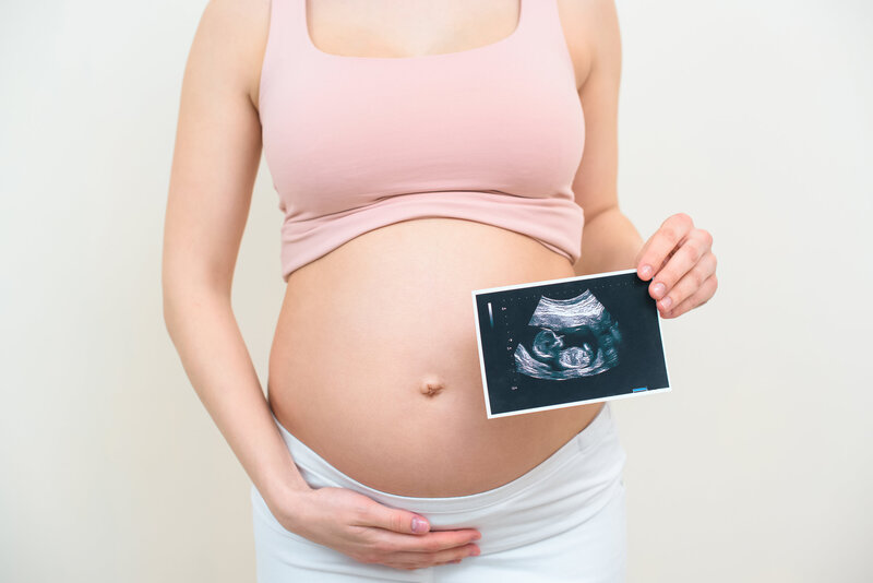 A woman holding her pregnant belly while holding an ultrasound image of the baby