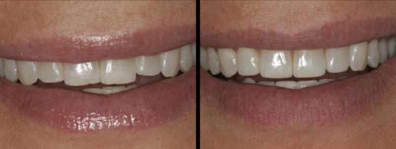 Screenshot 2020-01-26 at 22.45.50