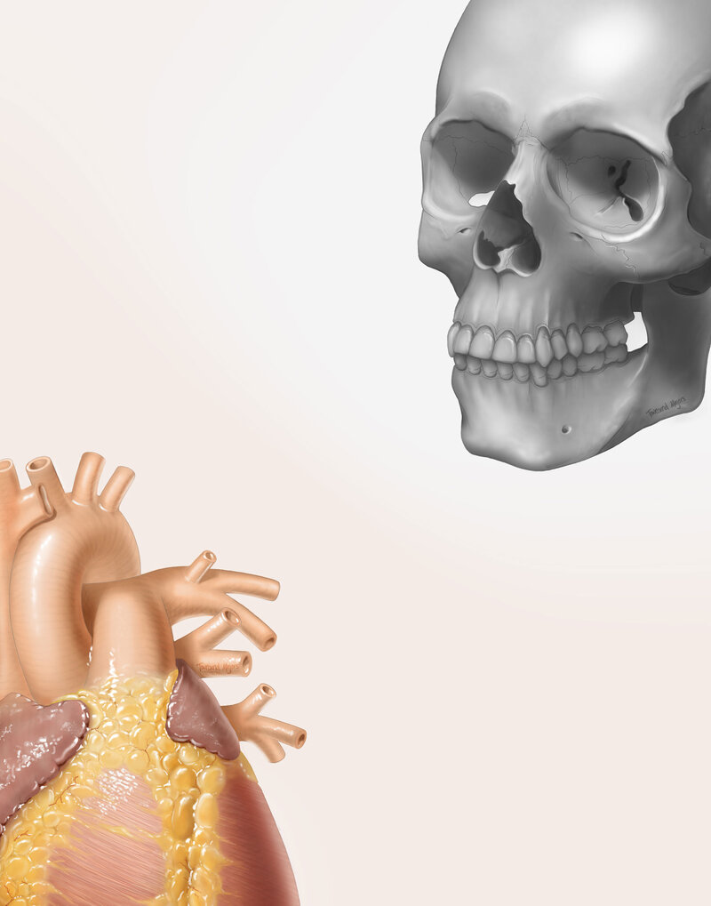 Townsend's heart and skull illustration
