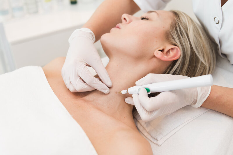 “Huidtherapeut behandelt acne en pigmentvlekken zonder verwijzing”