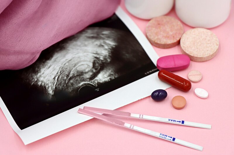Top view of an ultrasound photo, ovulation sticks, and fertility medication