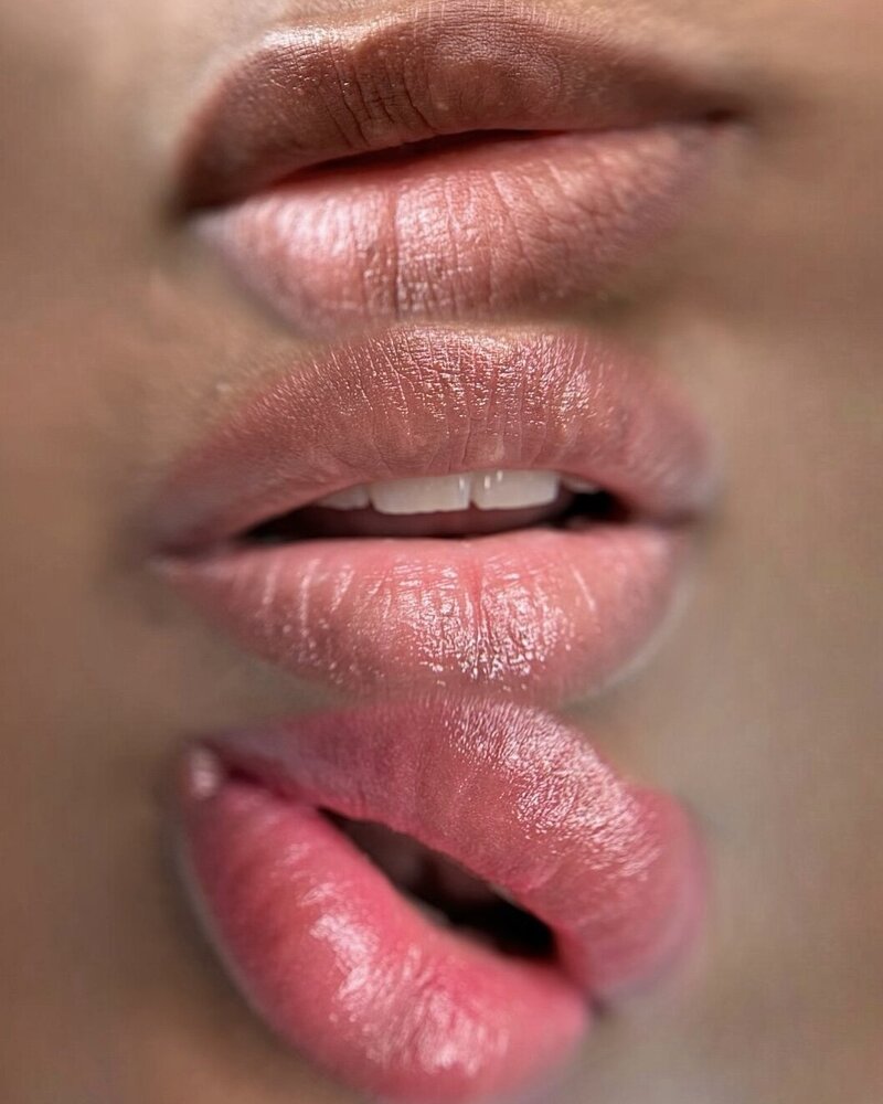 lips neutralization in New York