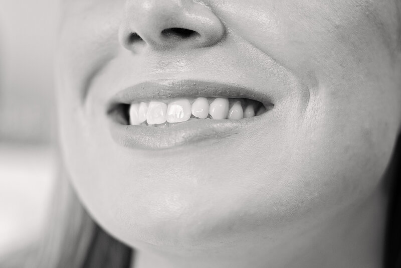 up close happy smile with new teeth