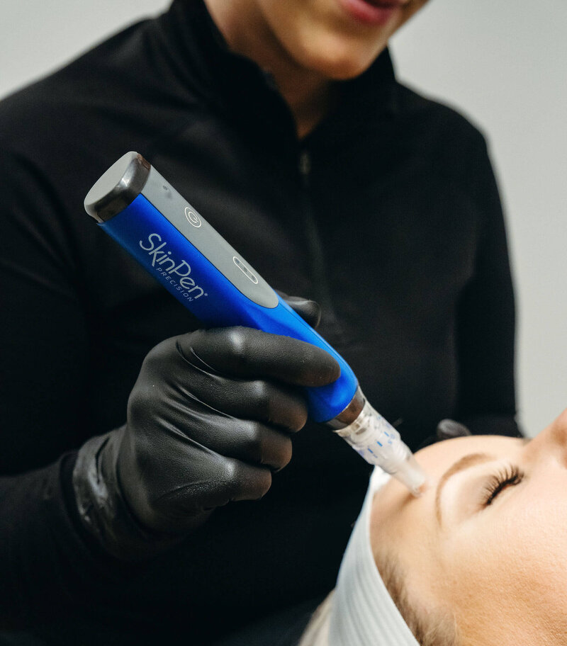 Close-up of SkinPen microneedling treatment being performed at Maxwell Aesthetics Salem, showing sterile technique and client comfort