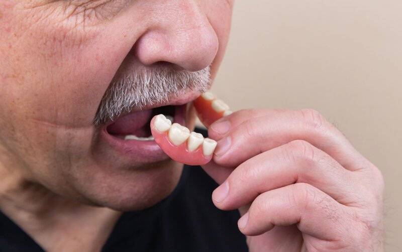 A photo to represent our denture services