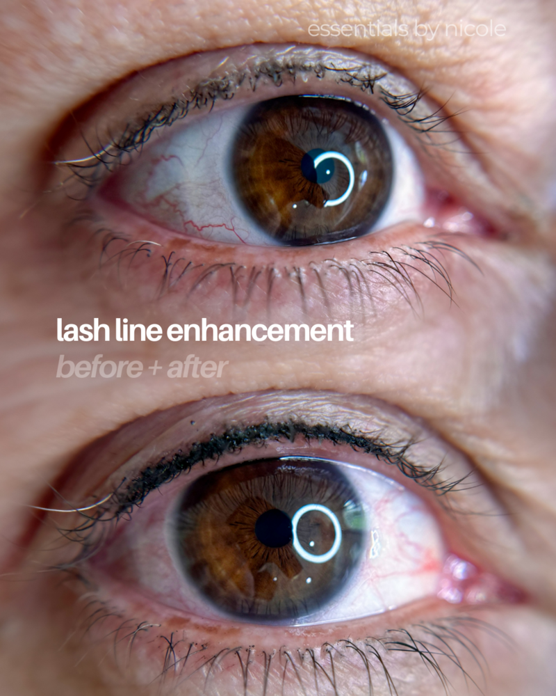 before and after. Permanent liner tattoo designed to subtly thicken the lash base

