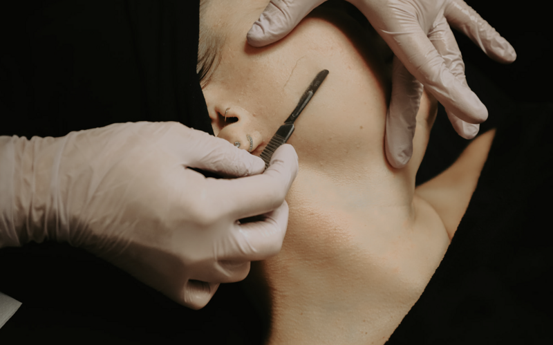 Dermaplane Cedar Rapids Dermaplane Cedar Falls