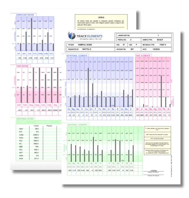 Hair Tissue Mineral Analysis (HTMA) report displaying mineral ratios, toxic metals, and nutrient levels used to assess metabolism, stress, and mineral balance.
