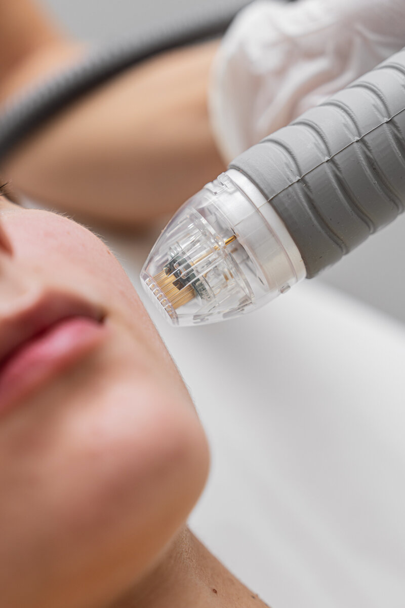 Non-Surgical Aesthetic Treatments at Blackstone Med Spa