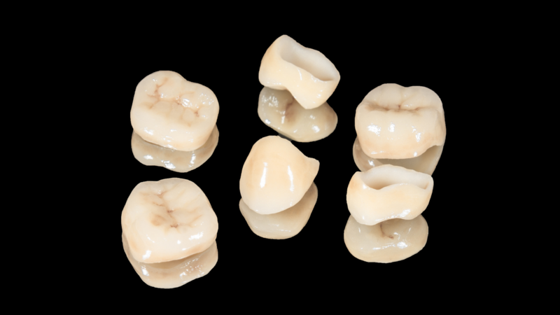 A photo of dental crowns on a black surface.