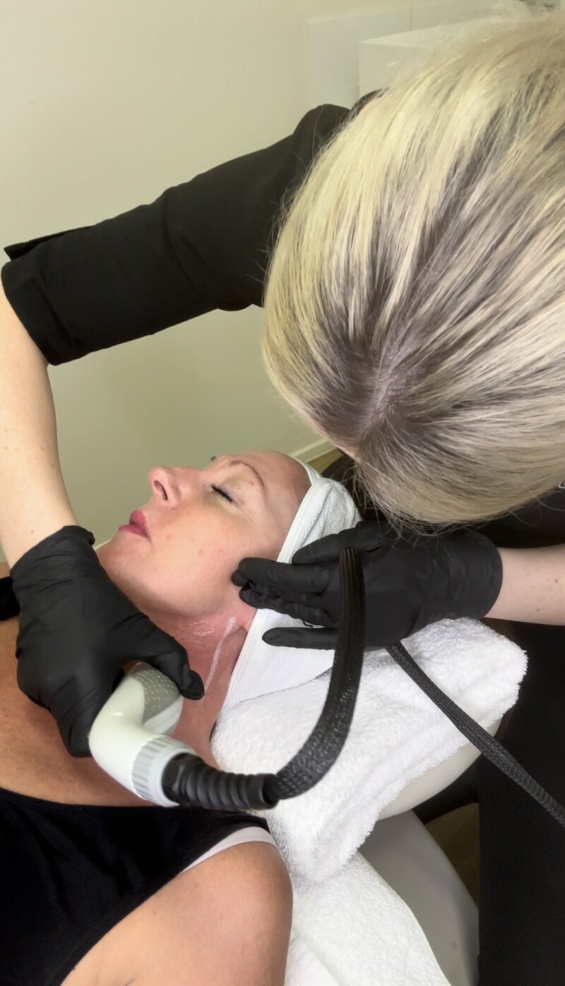 IPL Rejuvenation treatment at Luscious Skin & Beauty Warrnambool