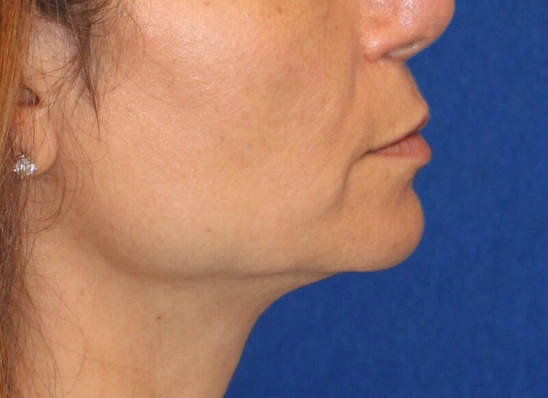 MedSpa Staff Looking At Camera