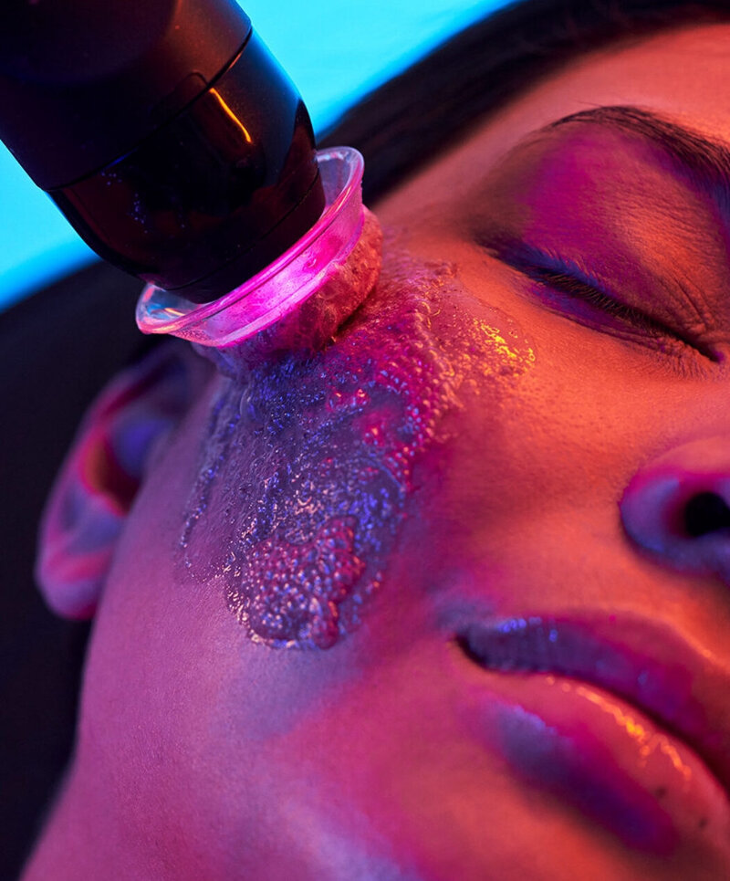Professional chemical peels at Luna Skin, College Station TX esthetician, to resurface and brighten the skin