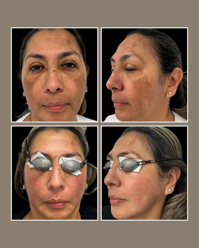 Skin Concerns - Glösense Dermatology and Aesthetics, Miami