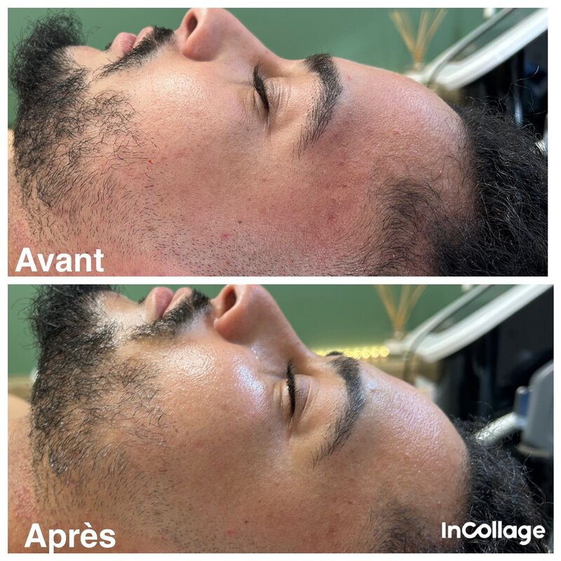 avant après du jetpeel
