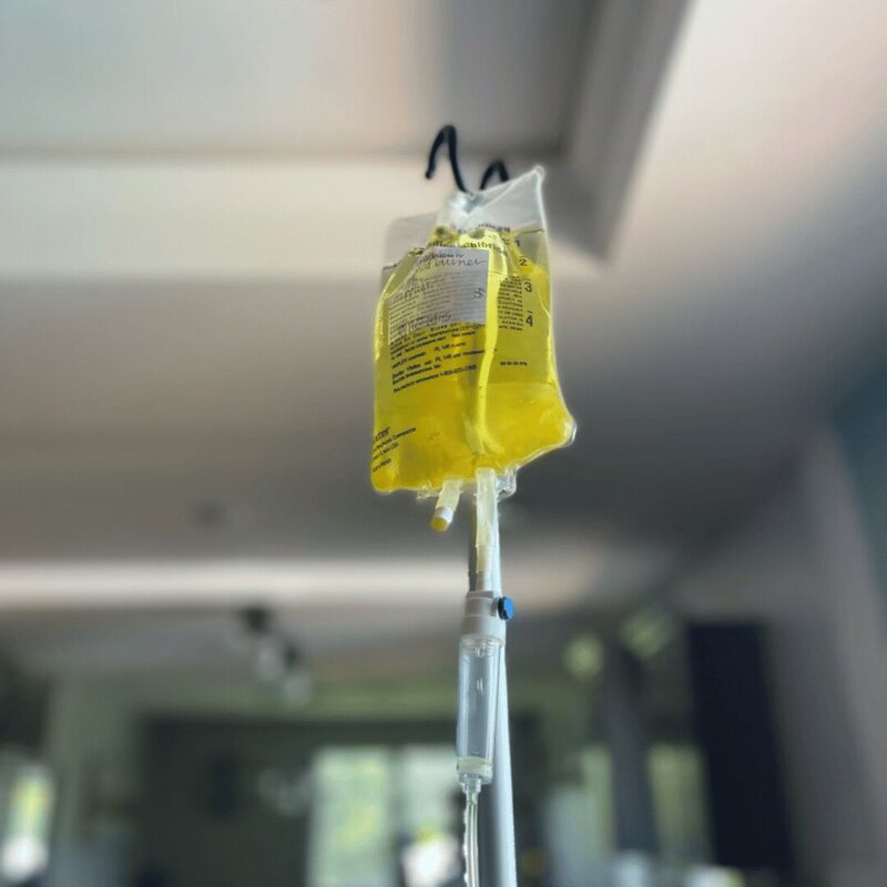 IV with yellow liquid handing in the IV Lounge
