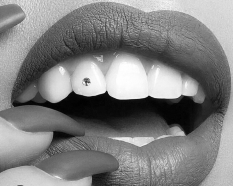 tooth-gem