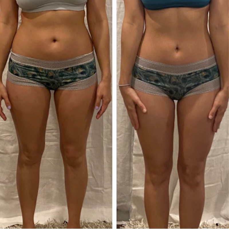 Before and after template_3FORMA Results-02