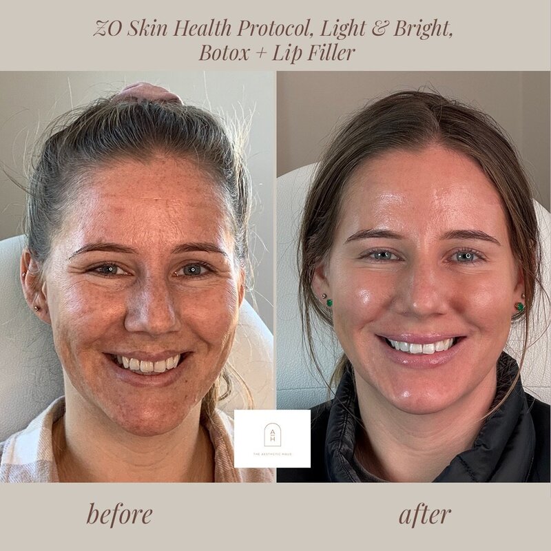 Medspa Treatments Greensboro