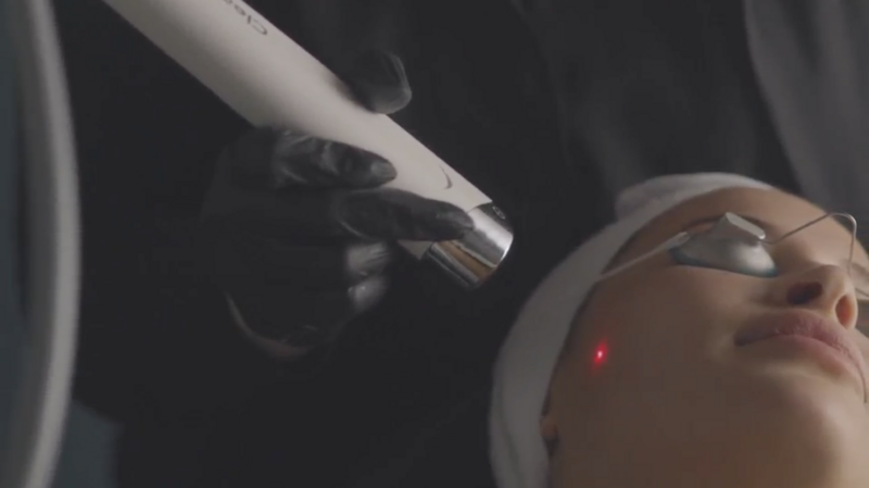 a happy girl getting clearsilk laser