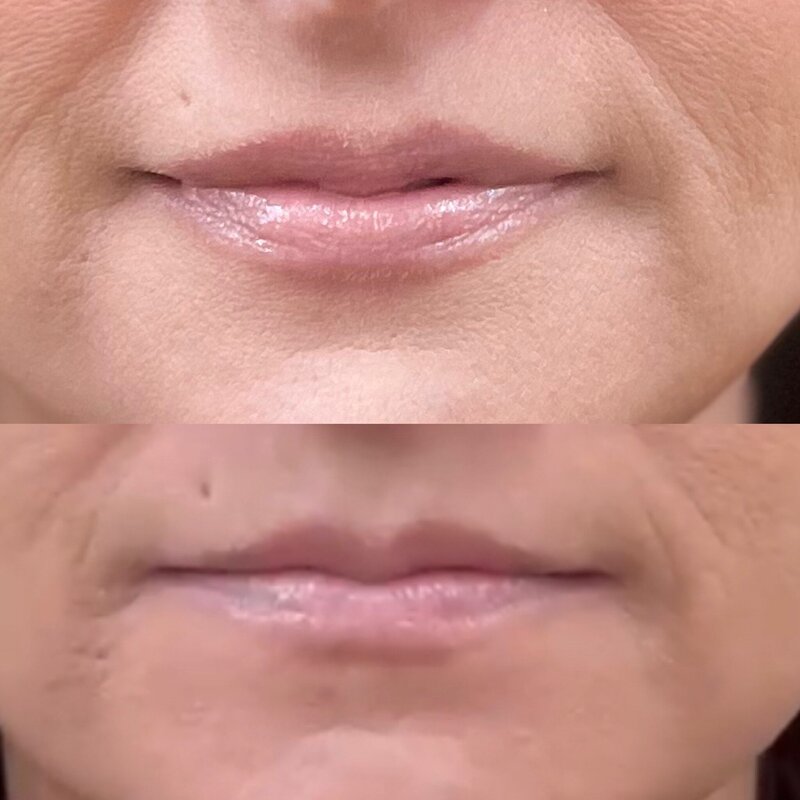Citrus and Willow Chemical Peel