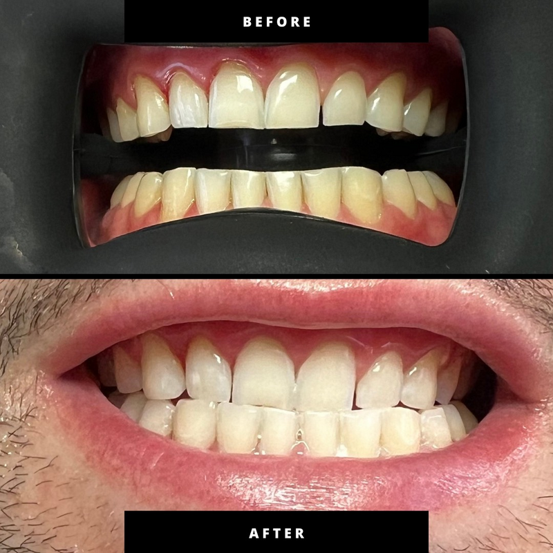 Simple Photocentric Before and After Instagram Post