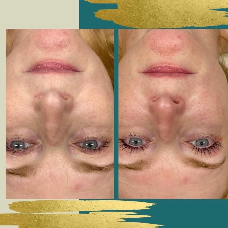 Woman Before and After