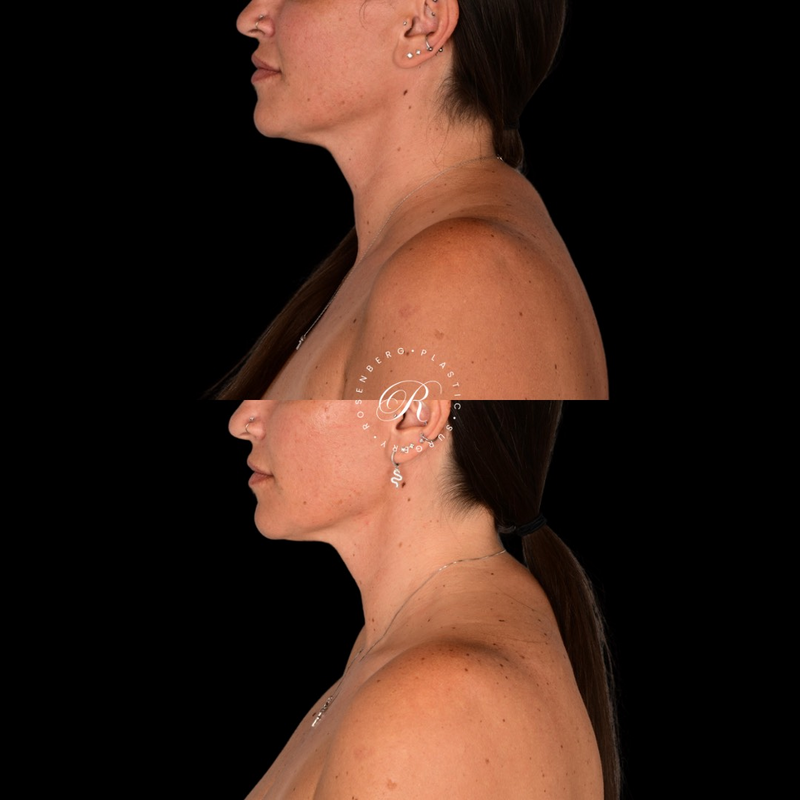 Copy of Template for Rosenberg Plastic Surgery B - 13