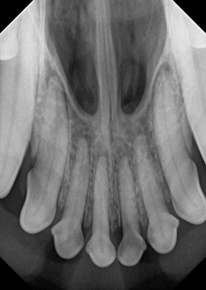 Dental xray