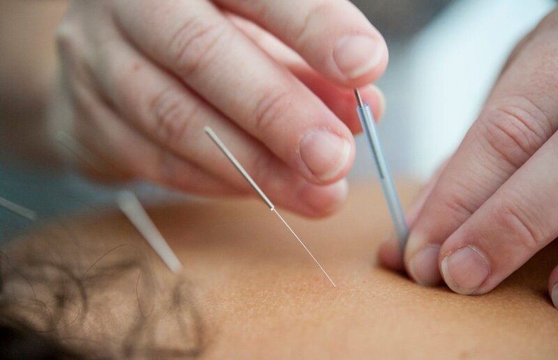 Book your appointment at Jade Therapies Yarmouth Acupuncture