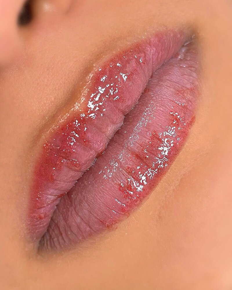 During Lips Healing Process don’t scratch, pick, scrab or stretch the scabs