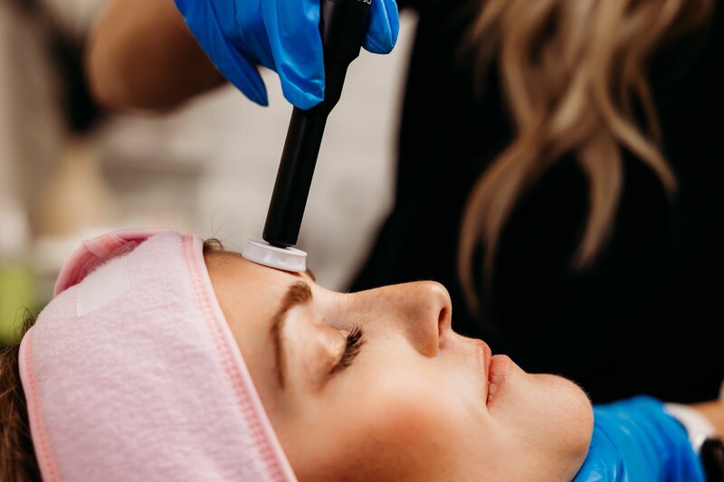 Microchanneling wand gliding over womans forehead