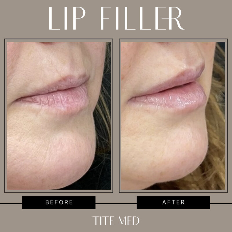 TITE-BEFOREAFTER copy 2