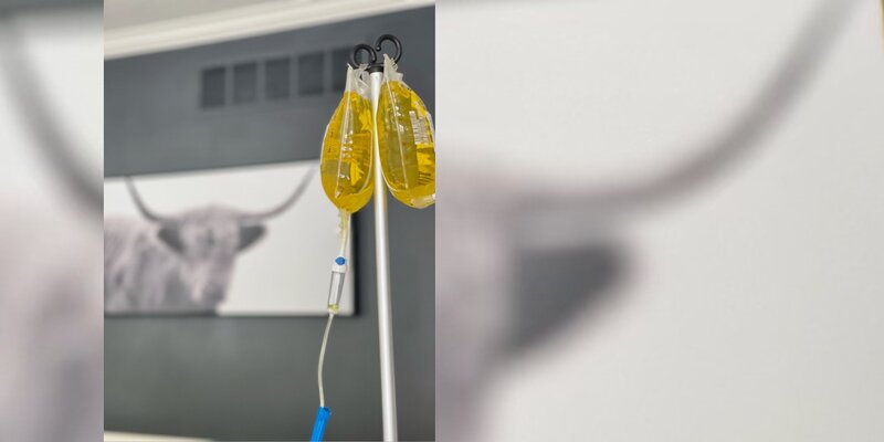 Two IV bags handing  filled with yellow liquid