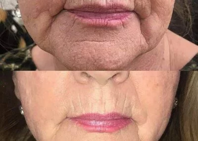 woman after skincare treatment