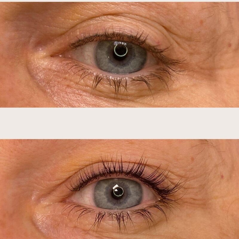 Before And After Lash Lift
