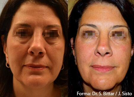 forma-before-after-dr-s-bittar-dr-j-sisto-preview-1
