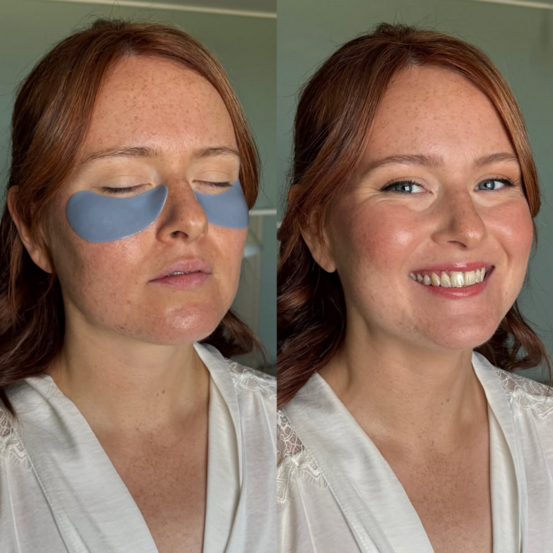 Beige Minimalist Skincare Before and After Instagram Post (3)