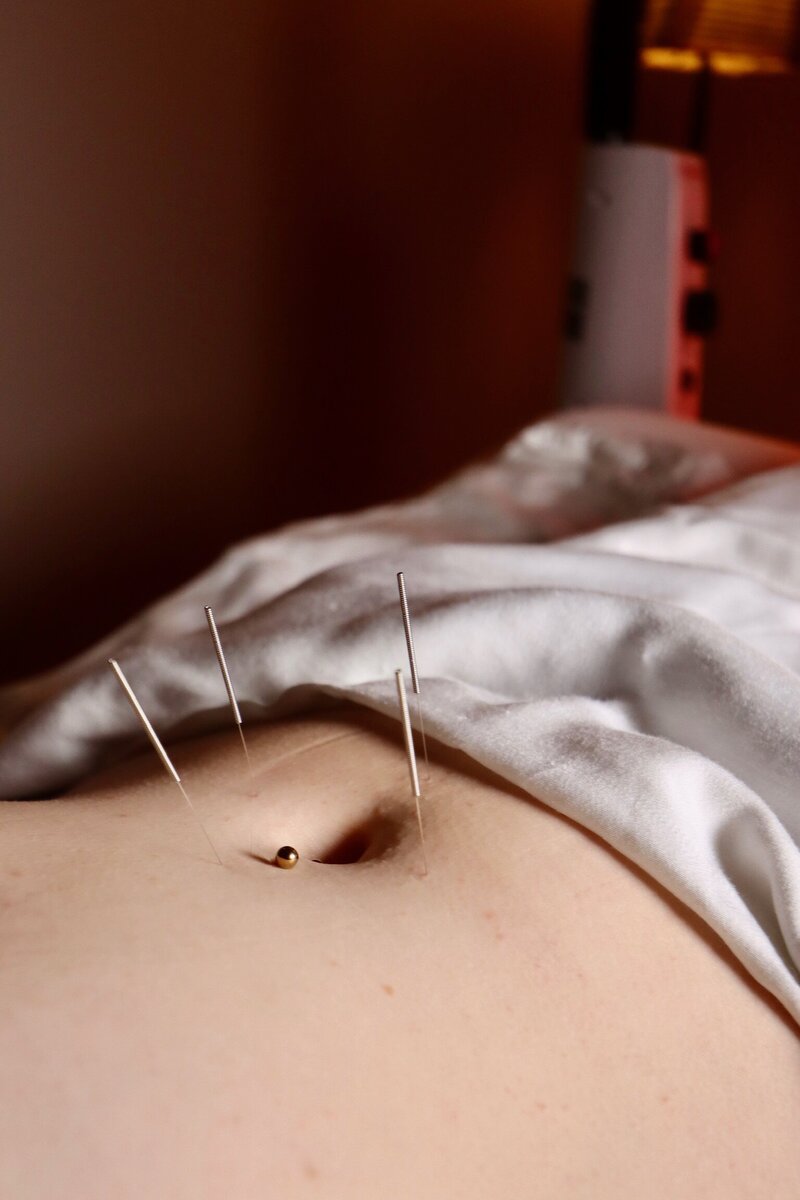 Opal Acupuncture and Wellness(17)