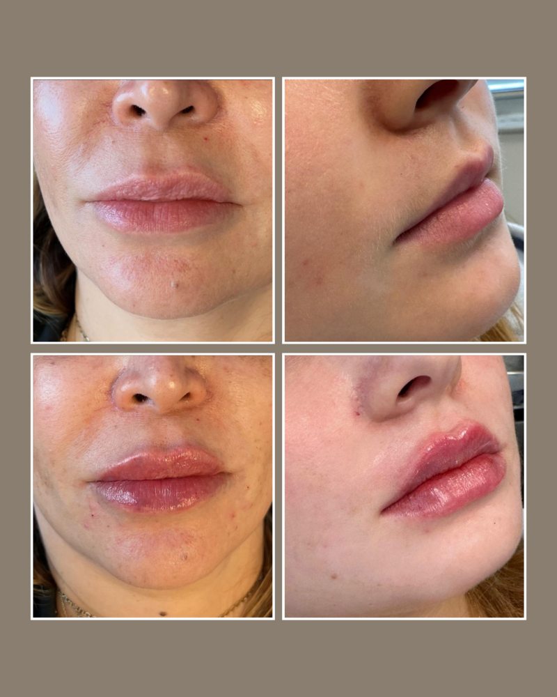 Skin Concerns - Glösense Dermatology and Aesthetics, Miami