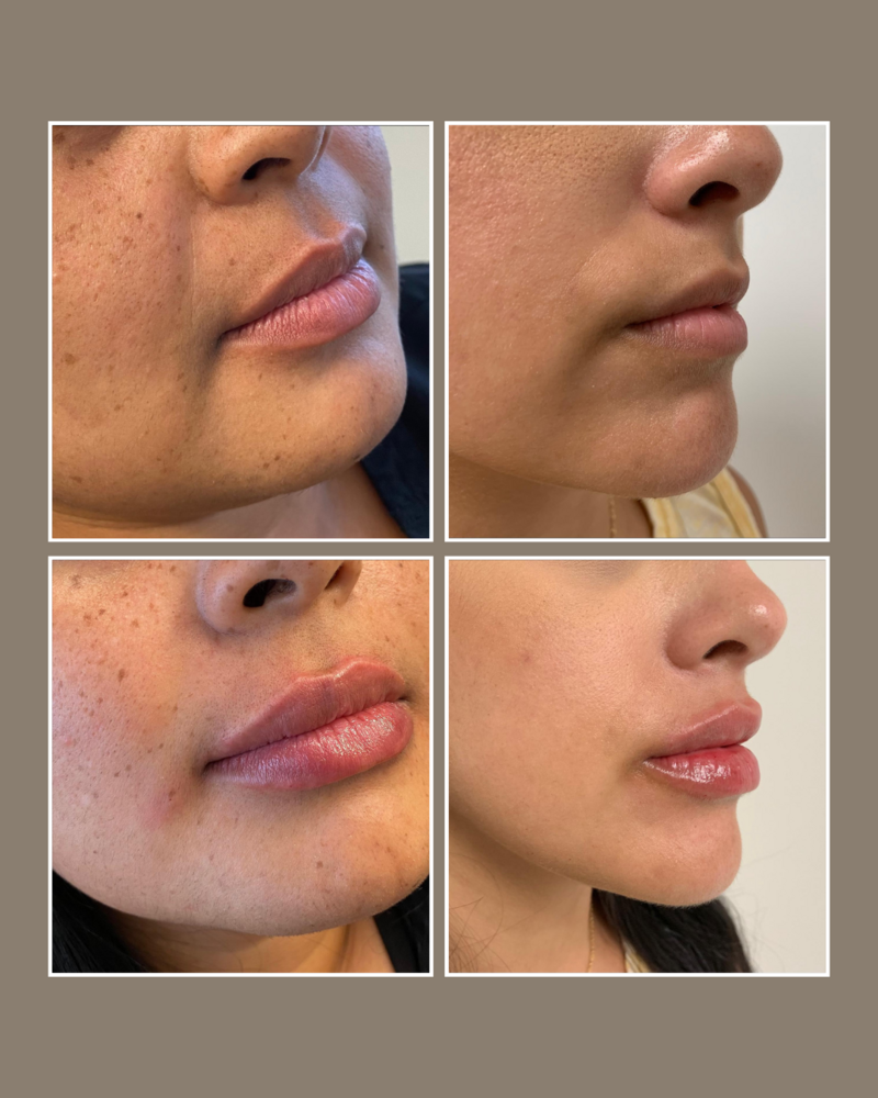 Skin Concerns - Glösense Dermatology and Aesthetics, Miami